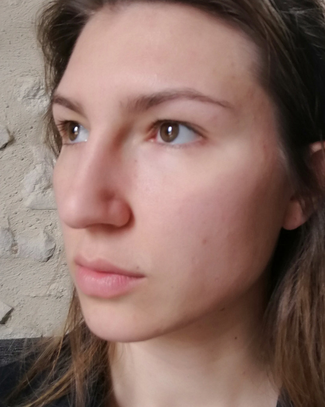 mon visage après sans acné sans imperfections